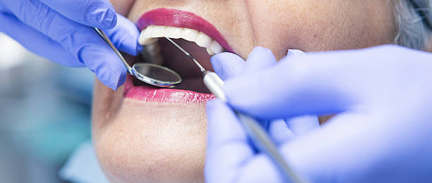 Best Emergency Tooth Extraction in Fair Oaks Ranch, TX